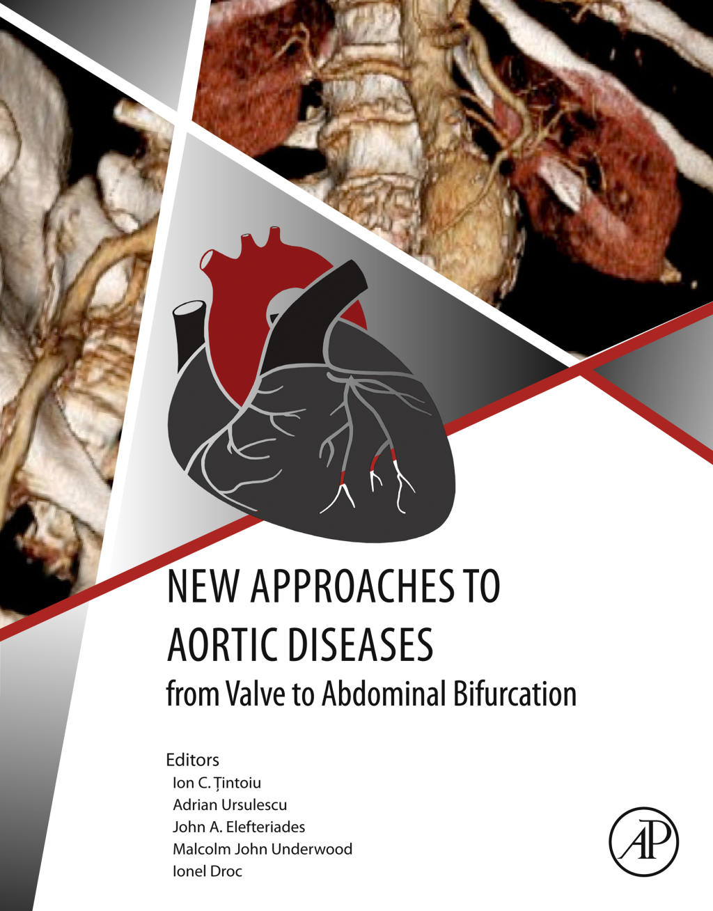 New Approaches to Aortic Diseases from Valve to Abdominal Bifurcation 