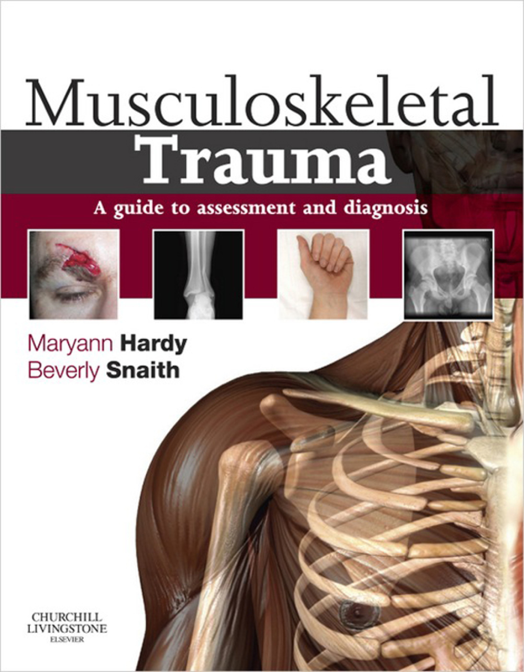 Musculoskeletal Trauma A Guide to Assessment and Diagnosis 