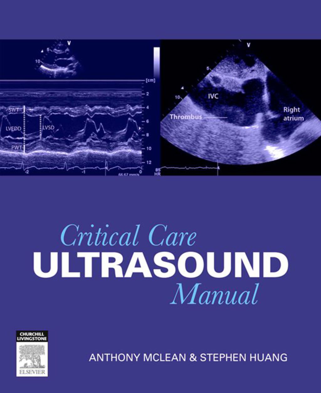 Critical Care Ultrasound Manual 1st Edition