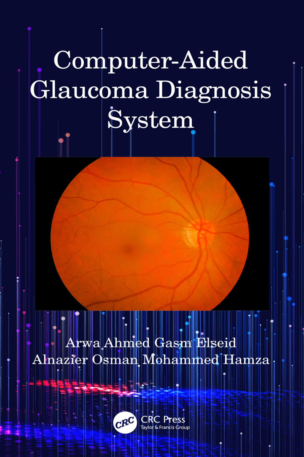 Computer-Aided Glaucoma Diagnosis System 1st Edition