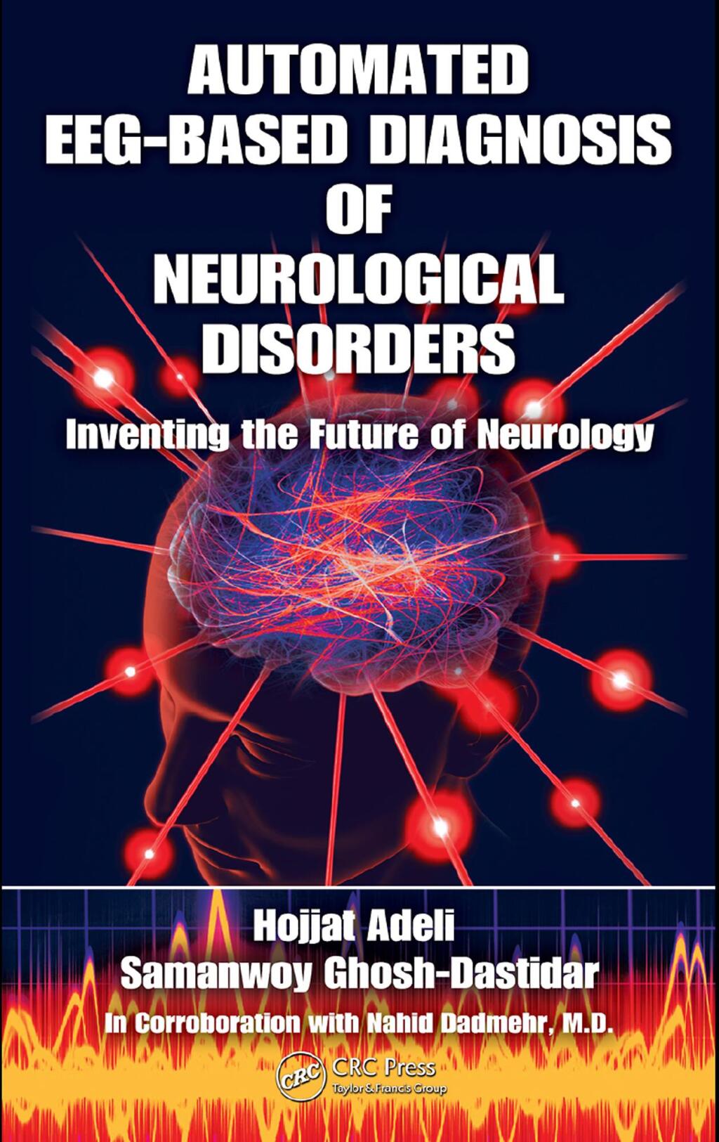 Automated EEG-Based Diagnosis of Neurological Disorders Inventing the Future of Neurology 1st Edition