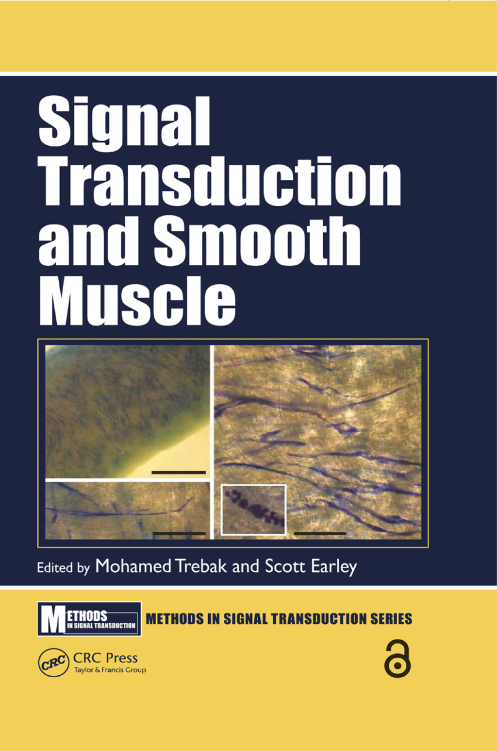 Signal Transduction and Smooth Muscle 1st Edition
