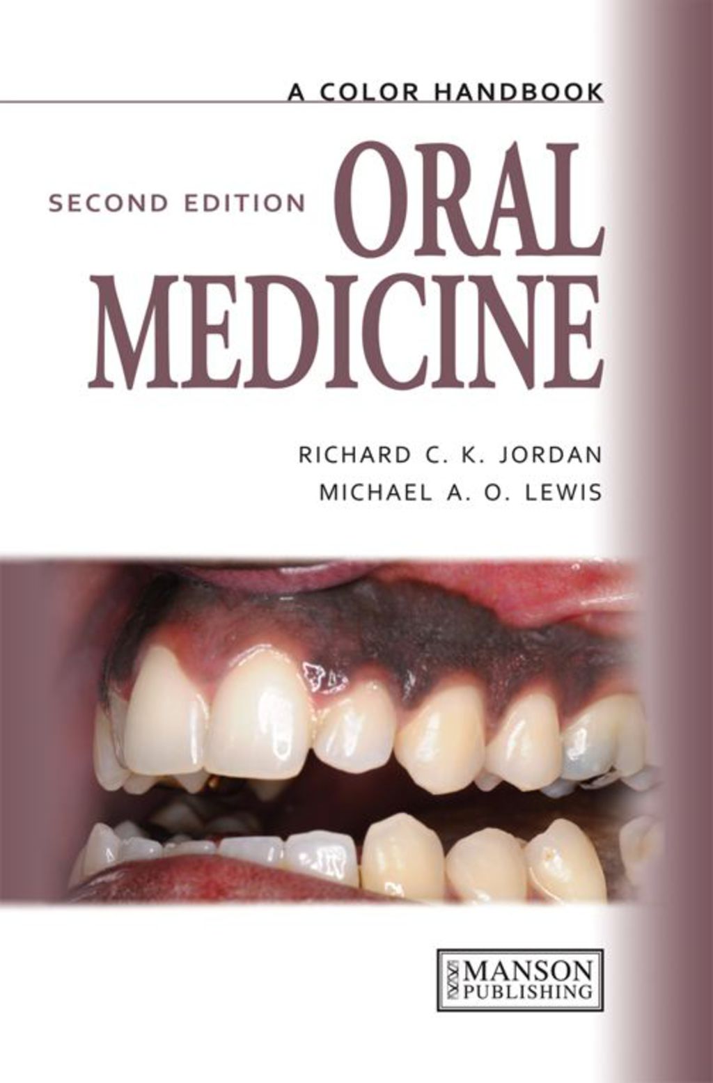 Oral Medicine 2nd Edition