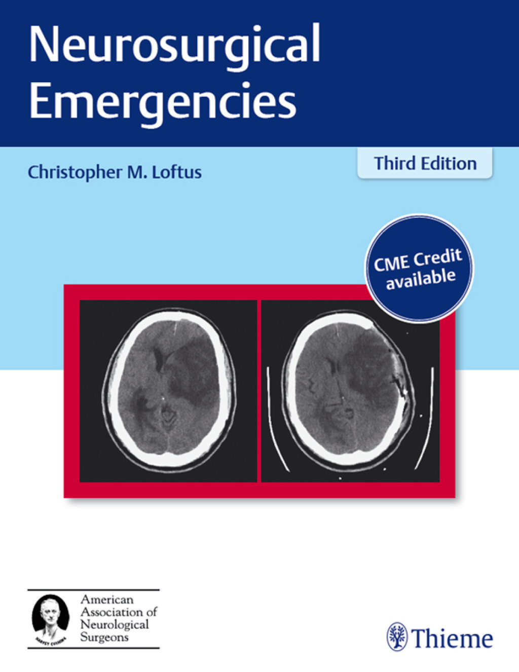 Neurosurgical Emergencies 3rd Edition