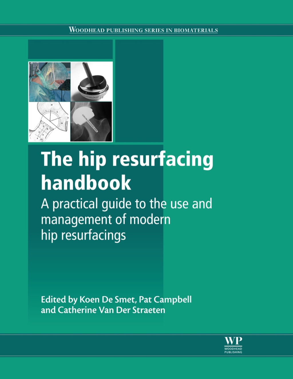 The Hip Resurfacing Handbook: A Practical Guide to the Use and Management of Modern Hip Resurfacings 