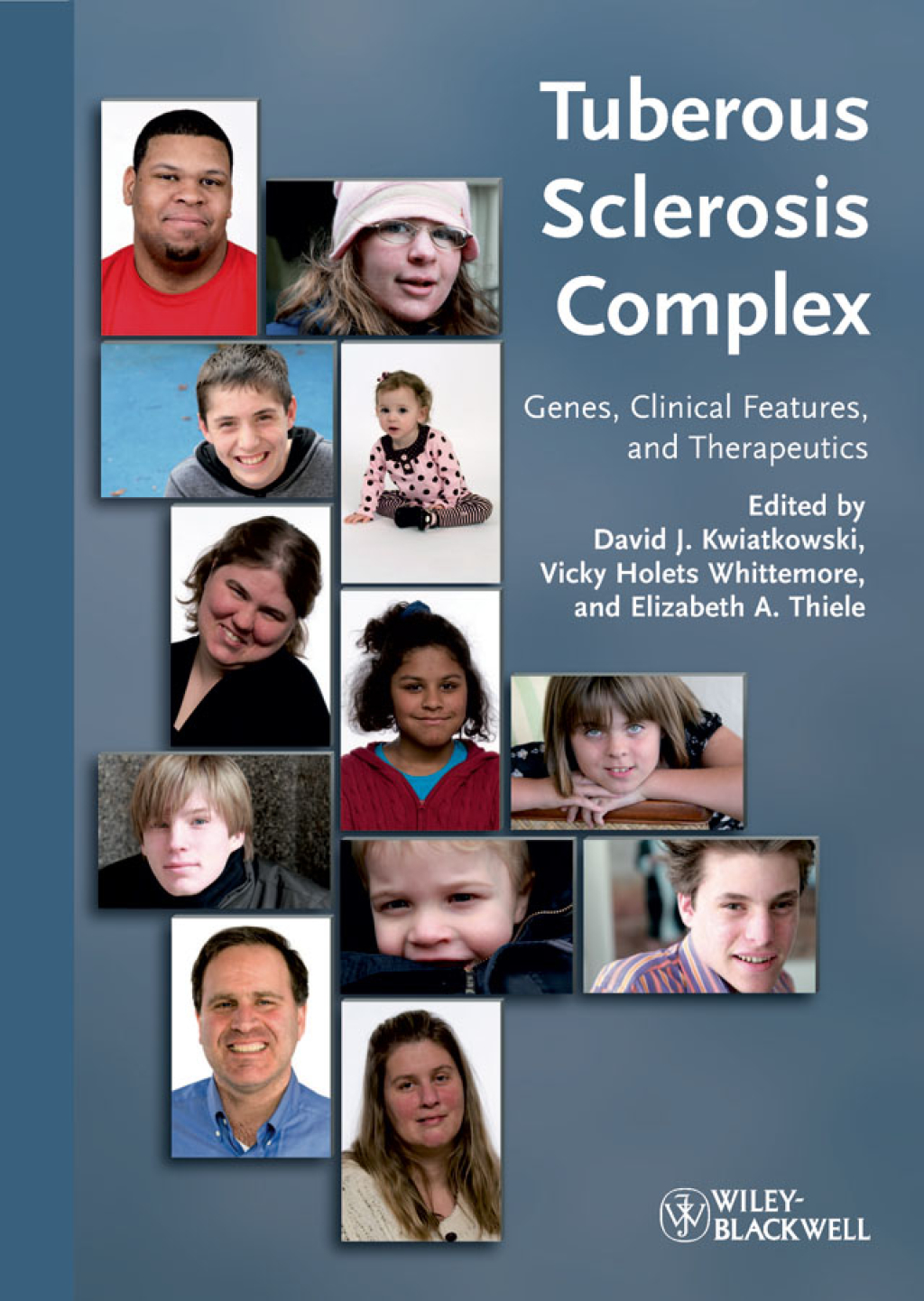 Tuberous Sclerosis Complex: Genes, Clinical Features and Therapeutics Genes, Clinical Features and Therapeutics 1st Edition